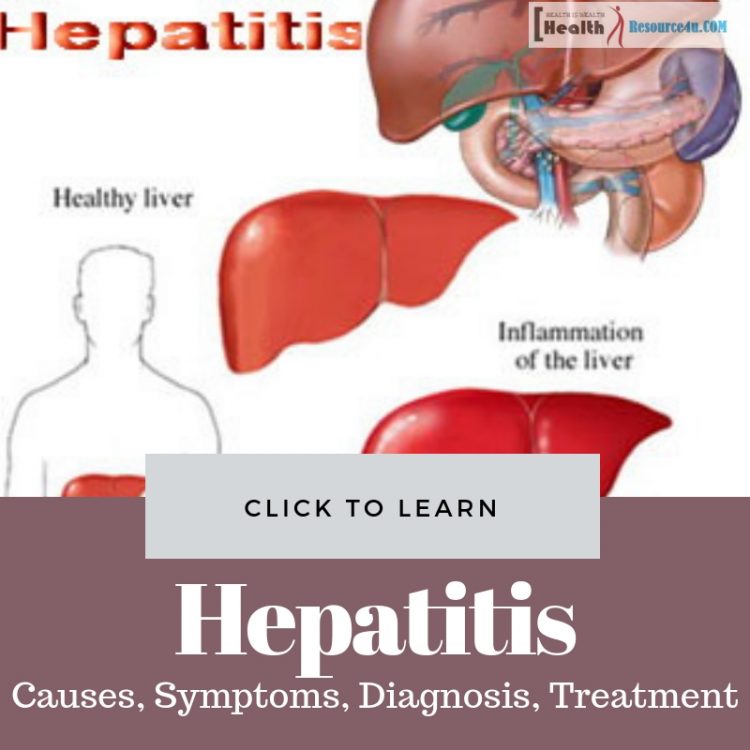 Hepatitis: Causes, Symptoms, Diagnosis and Treatment