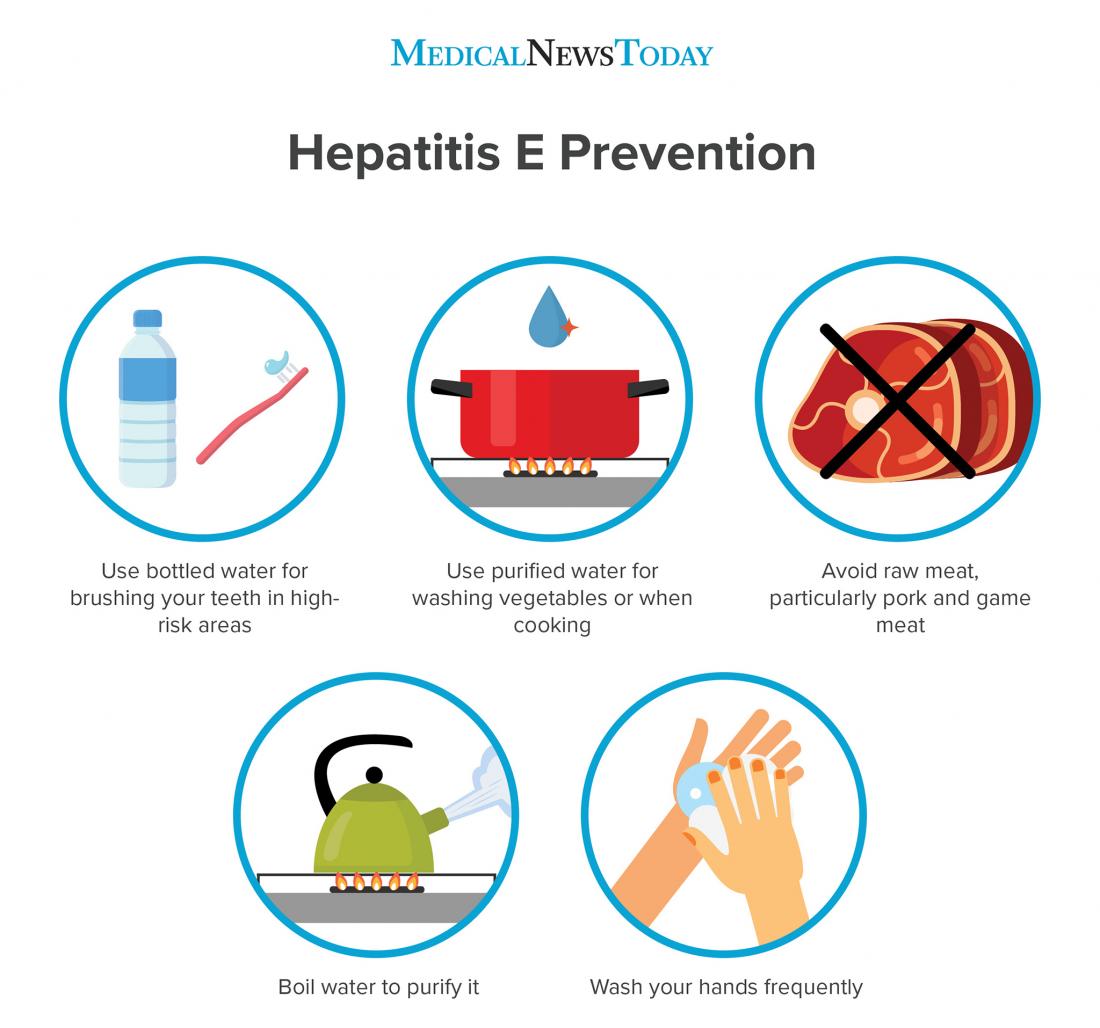 Hepatitis E: Causes, symptoms, and treatment