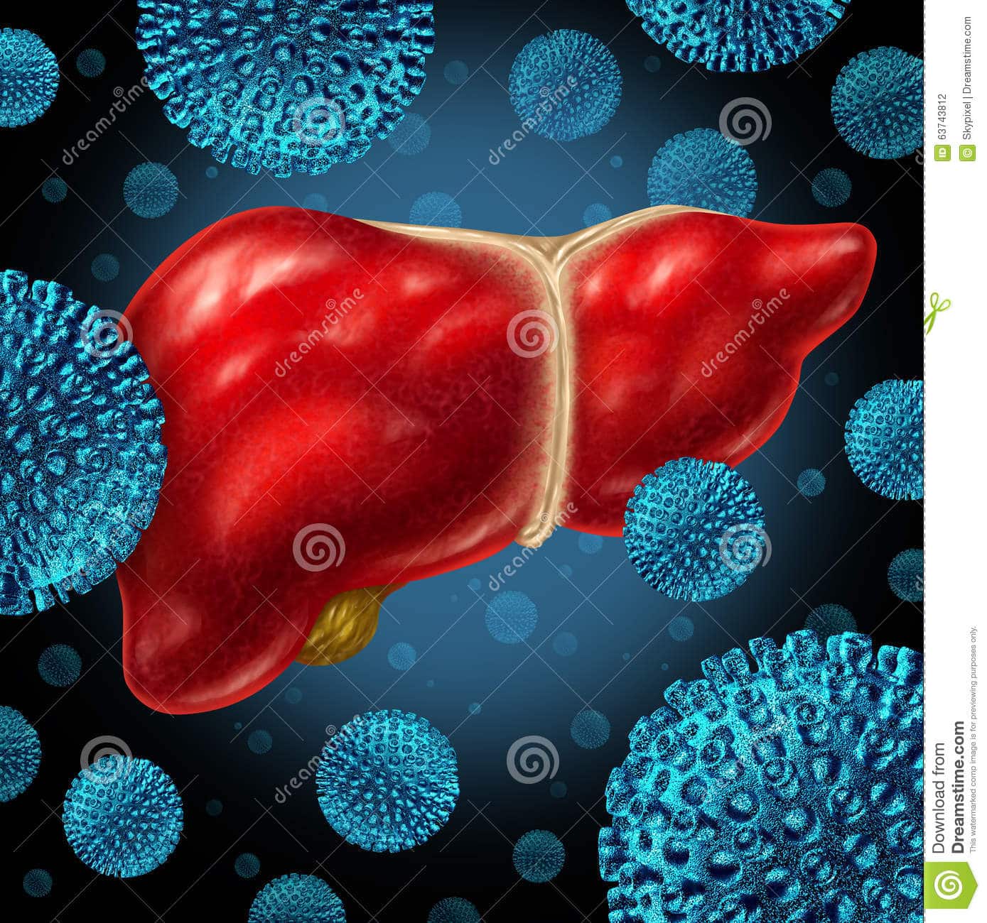 Hepatitis Liver Infection stock illustration. Image of infection