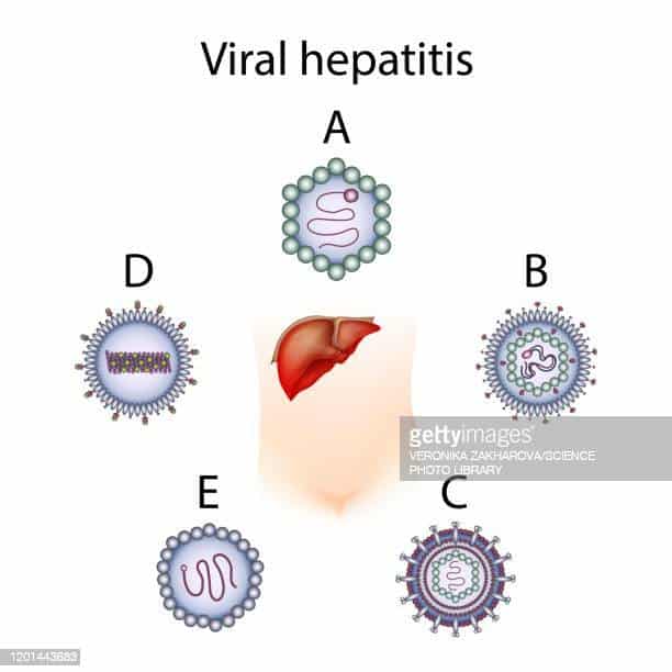 Hepatitis Photos et images de collection