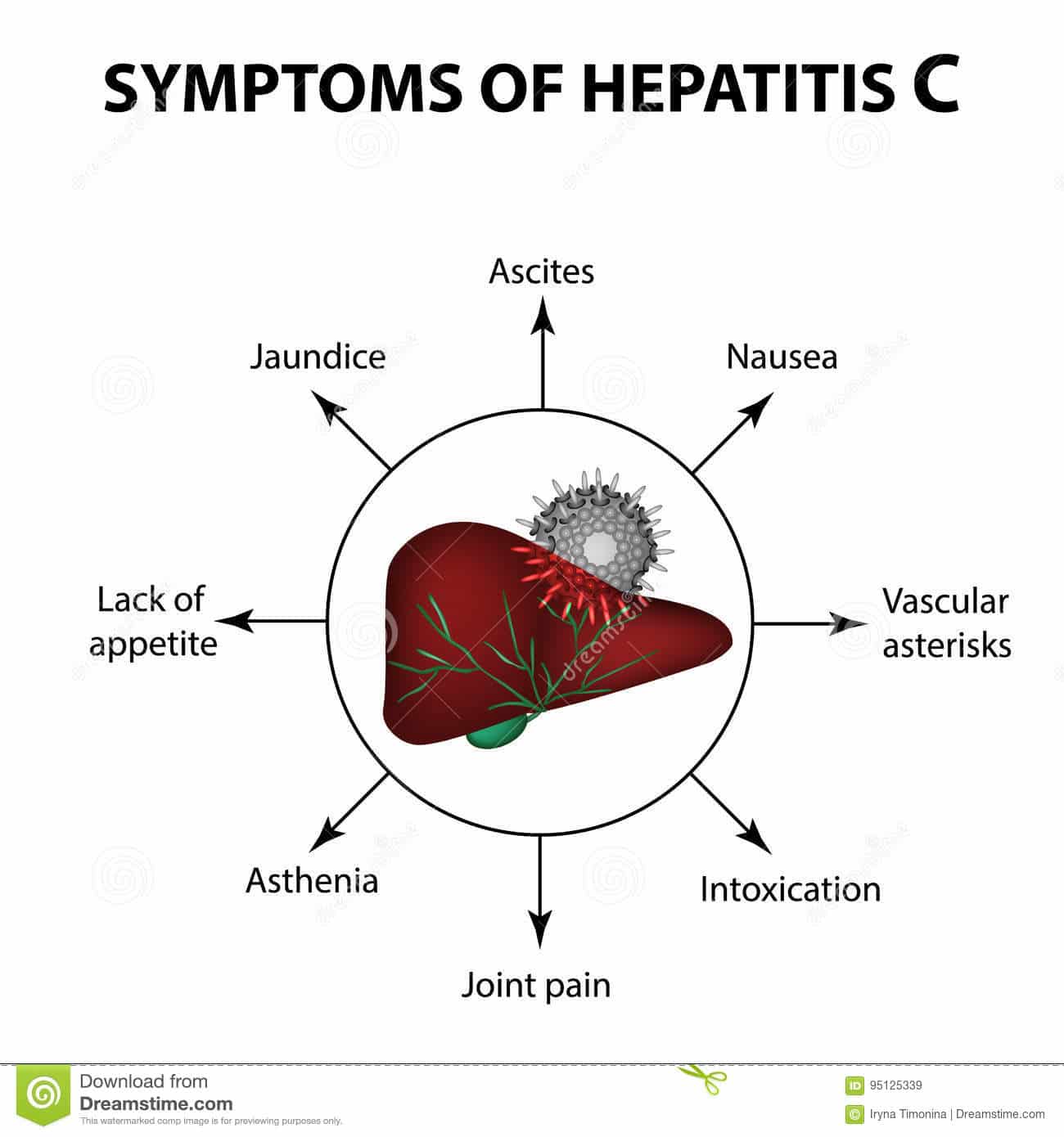 Hepatitis Symptoms Cartoon Vector