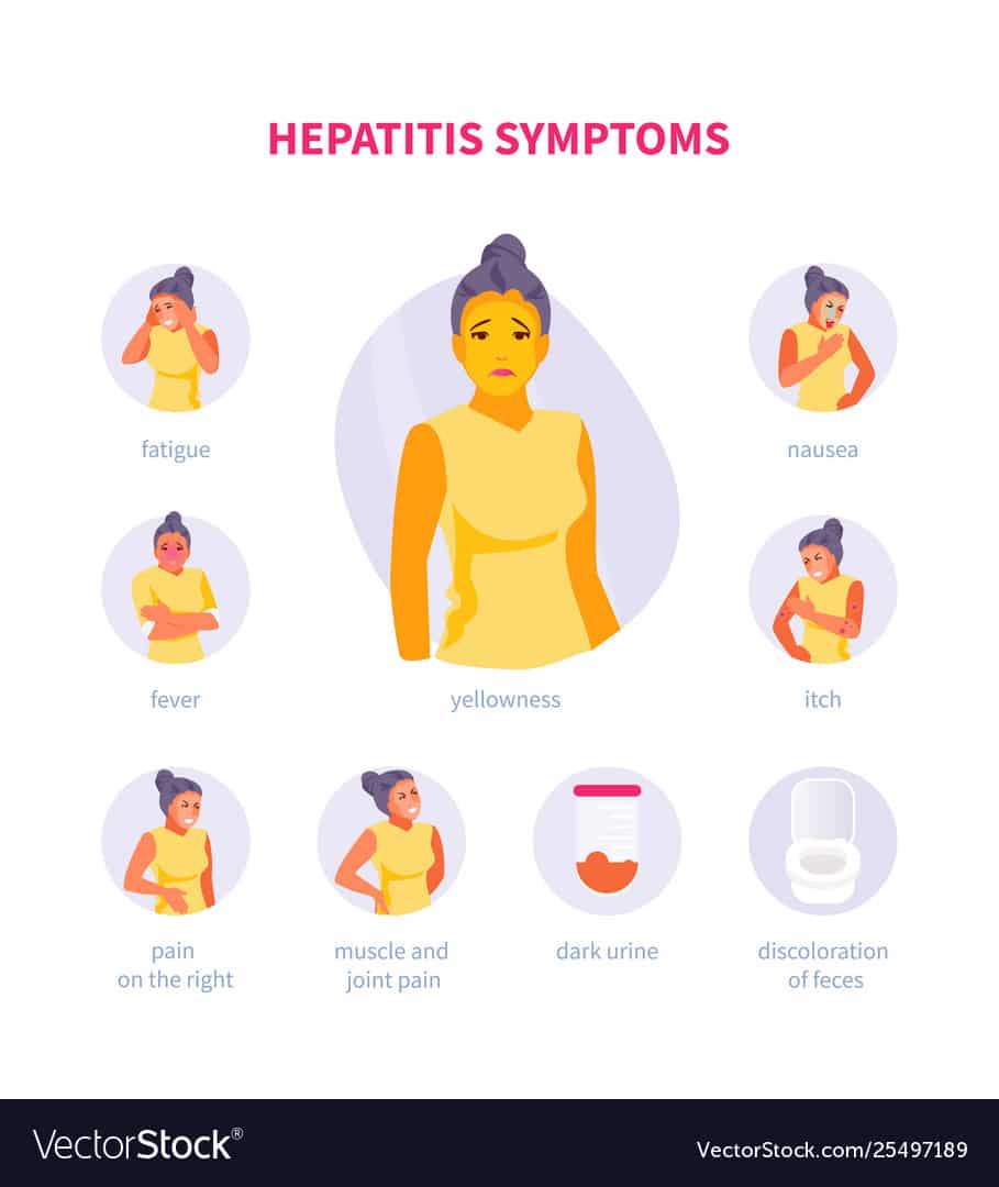 Hepatitis symptoms Royalty Free Vector Image