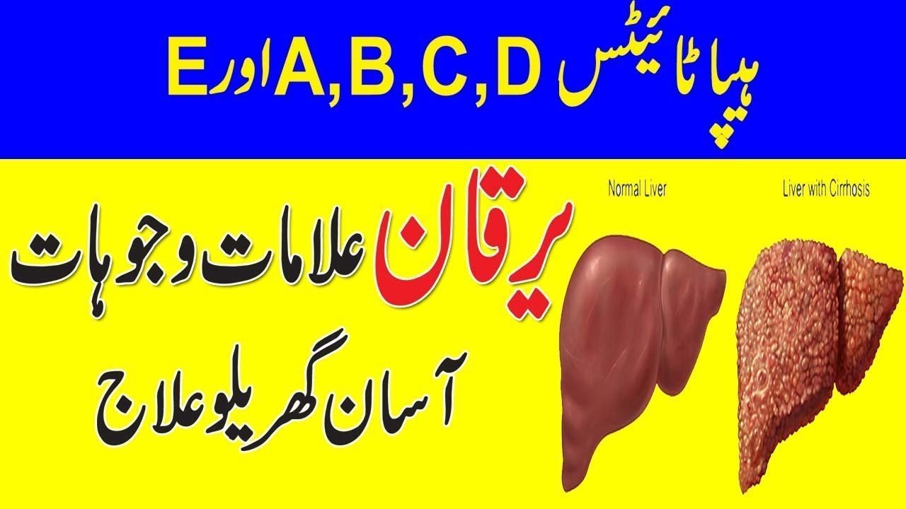 hepatitis, Yarkan ka ilaj in Urdu