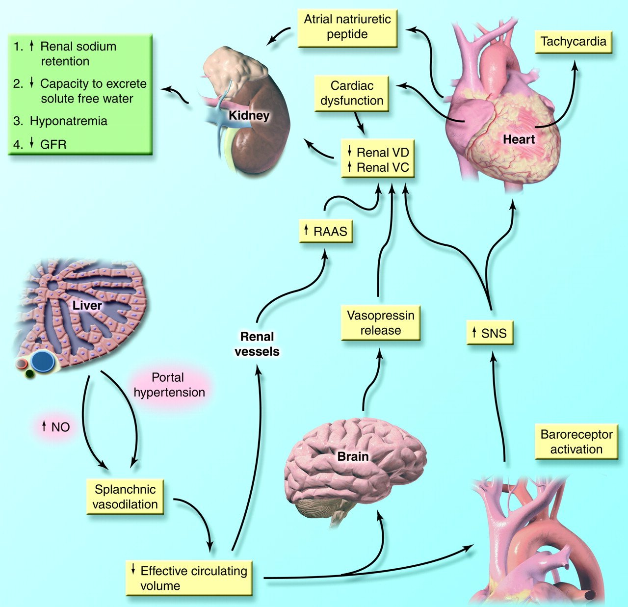 Hepatorenal Syndrome: Pathophysiology and Management ...