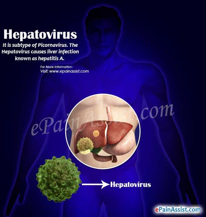 Hepatovirus: Infectious Hepatitis or Hepatitis A