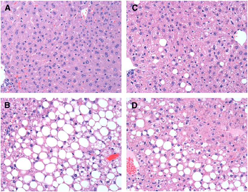 Histologic evaluation of hepatic steatosis in lean (A) and ...