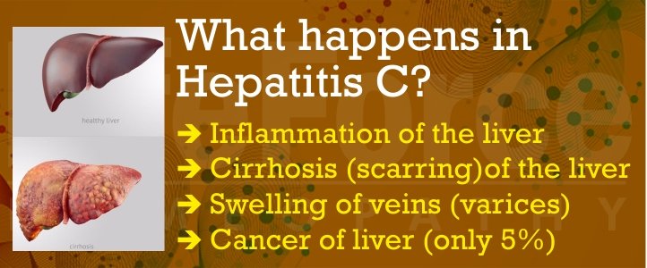 Homeopathic Treatment for Hepatitis C by Dr. Shah