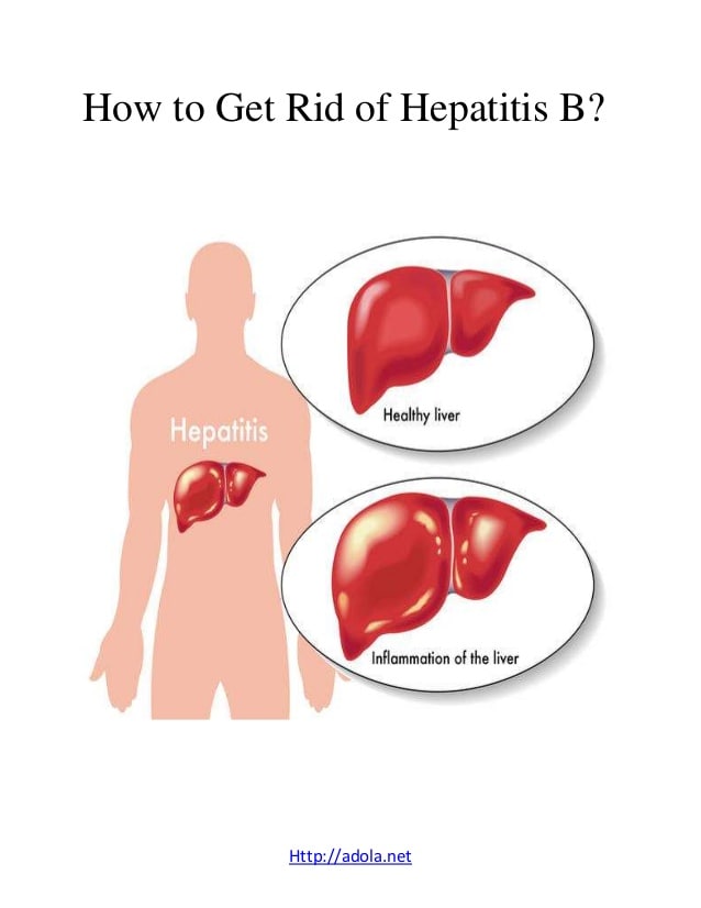 How to get rid of hepatitis B?
