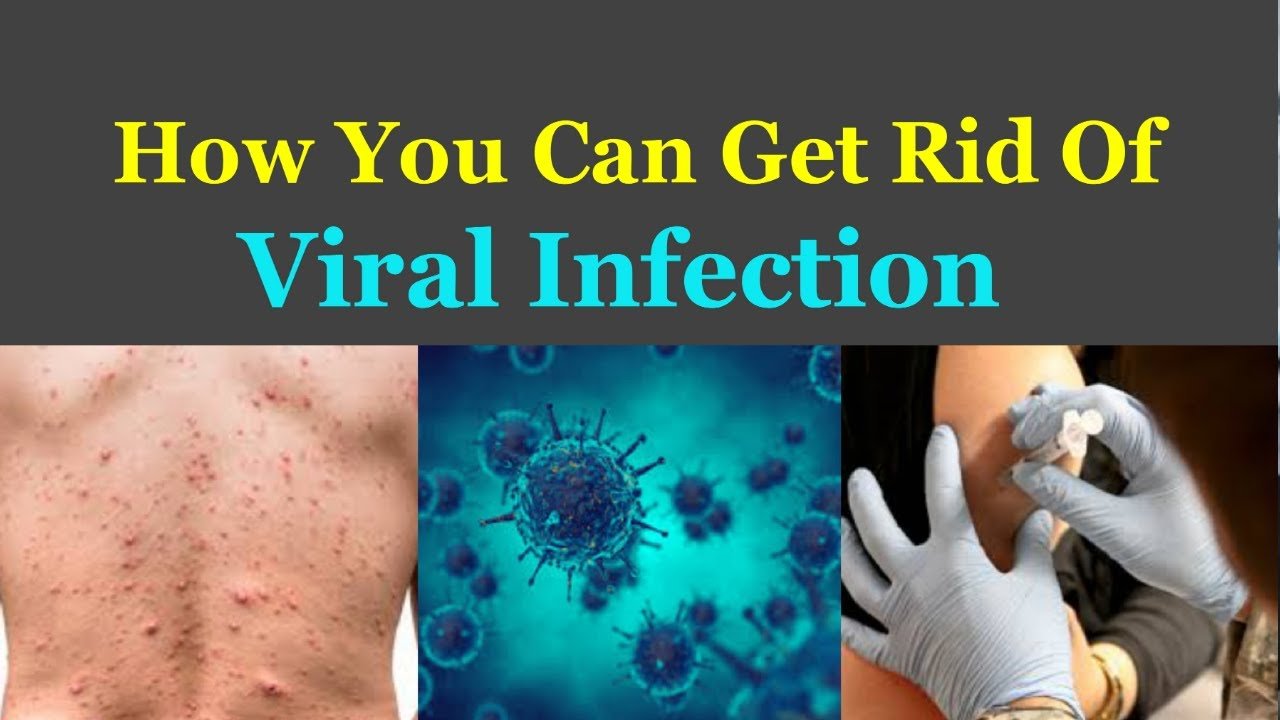 How You Can Get Rid Of Viral Infection