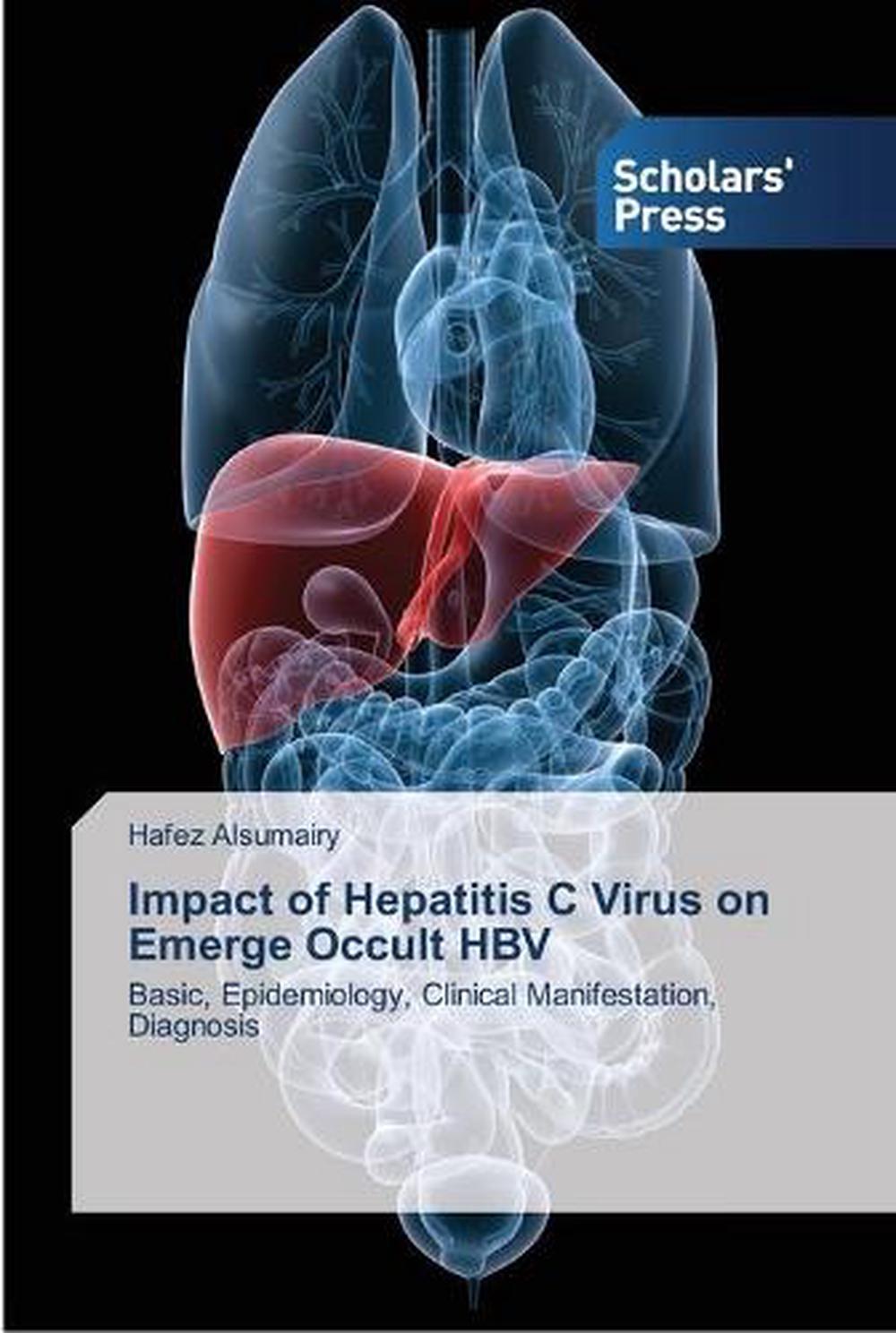 Impact of Hepatitis C Virus on Emerge Occult Hbv by Hafez ...