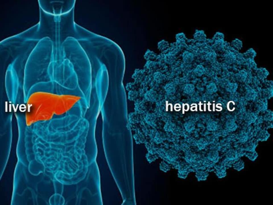 India develops cheap, effective treatment against Hep C, a ...