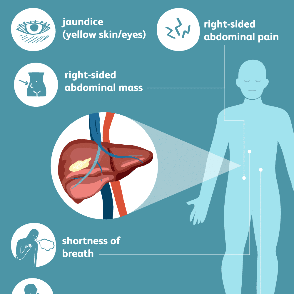 Liver Cancer: Overview and More