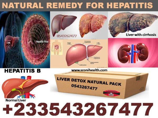 Natural Remedy for Hepatitis B and Fatty Liver Treatment in Ghana ...