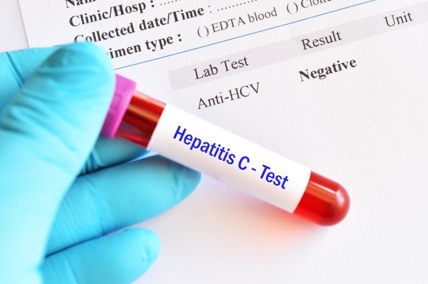 Patients who accepted infected kidneys cured of hepatitis C