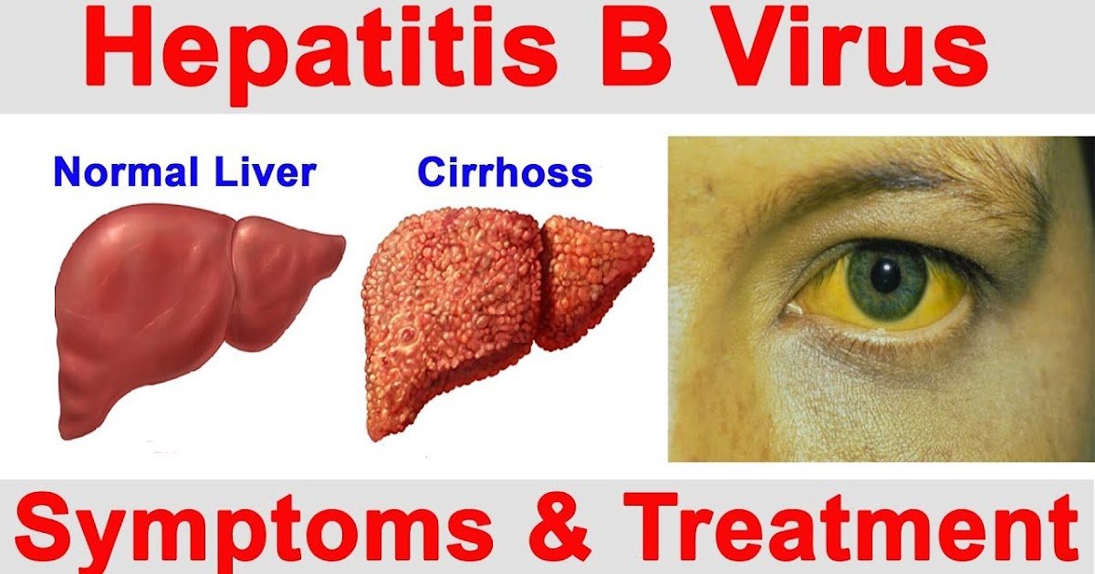 Rapid STD Testing: Hepatitis B: Causes, Symptoms and Treatment