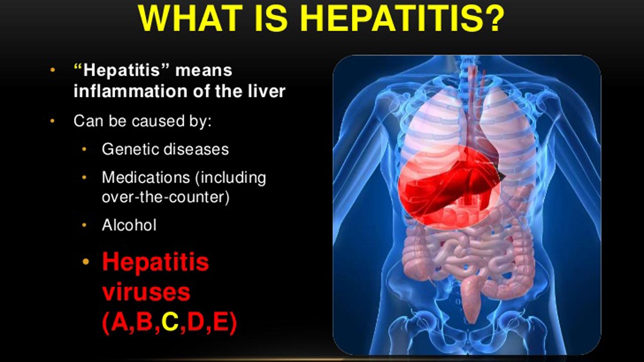 Reducing hepatitis