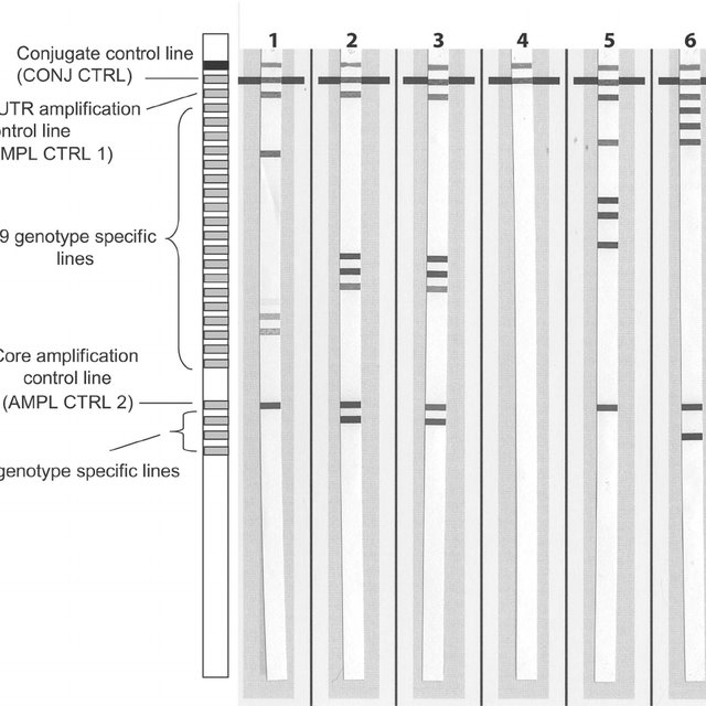 Schematic representation of the Versant HCV genotype assay ...
