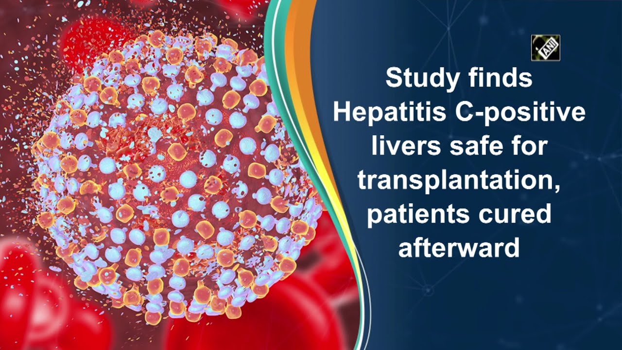 Study finds Hepatitis C