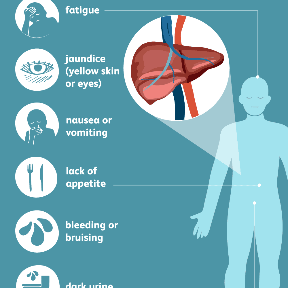 Symptoms Hepatitis B And C