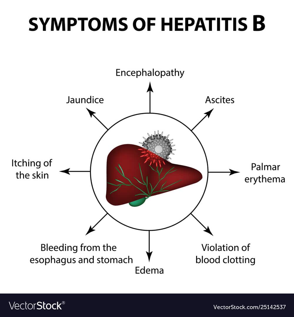 Symptoms hepatitis b liver world hepatitis Vector Image
