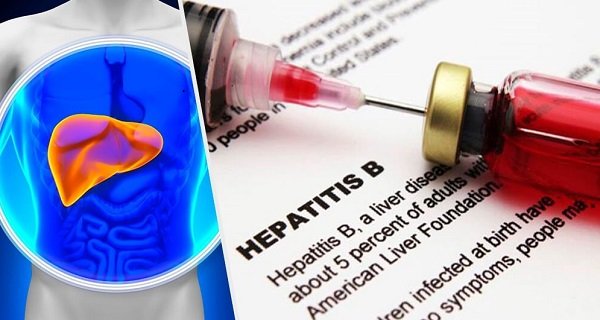 Symptoms of Hepatitis B
