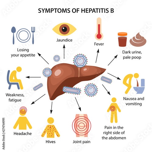 " Symptoms of Hepatitis B"  Stock image and royalty