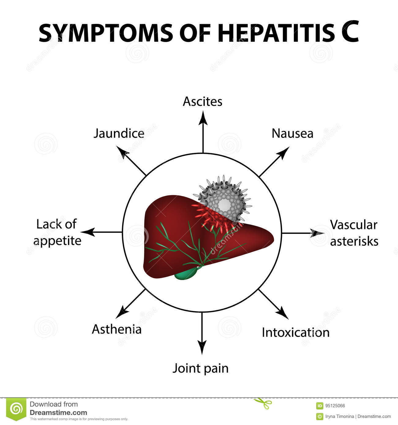 Symptoms Of Hepatitis C. Liver. World Hepatitis Day. July 28th ...