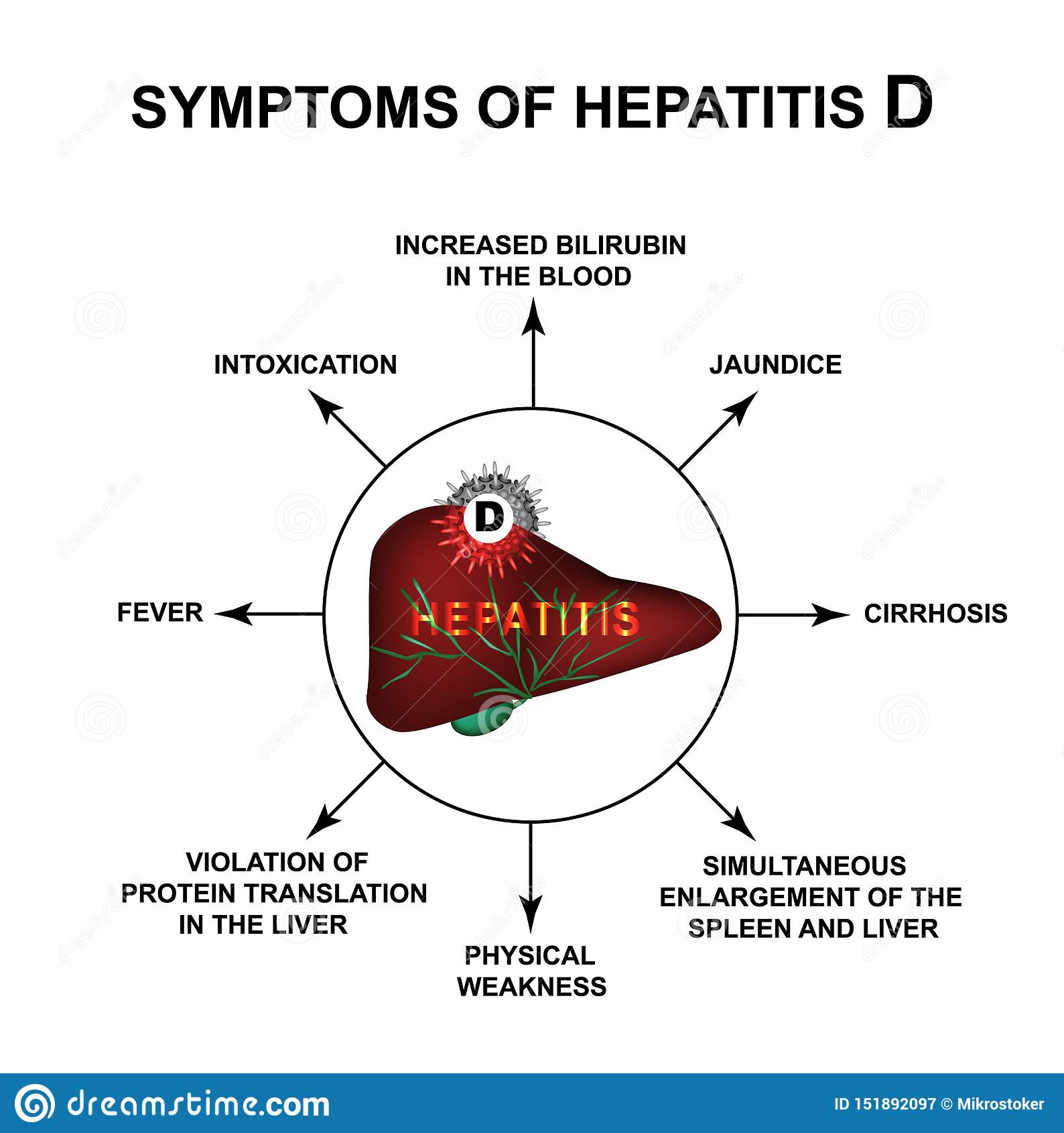 Symptoms of hepatitis d. world hepatitis day. infographics. vector ...