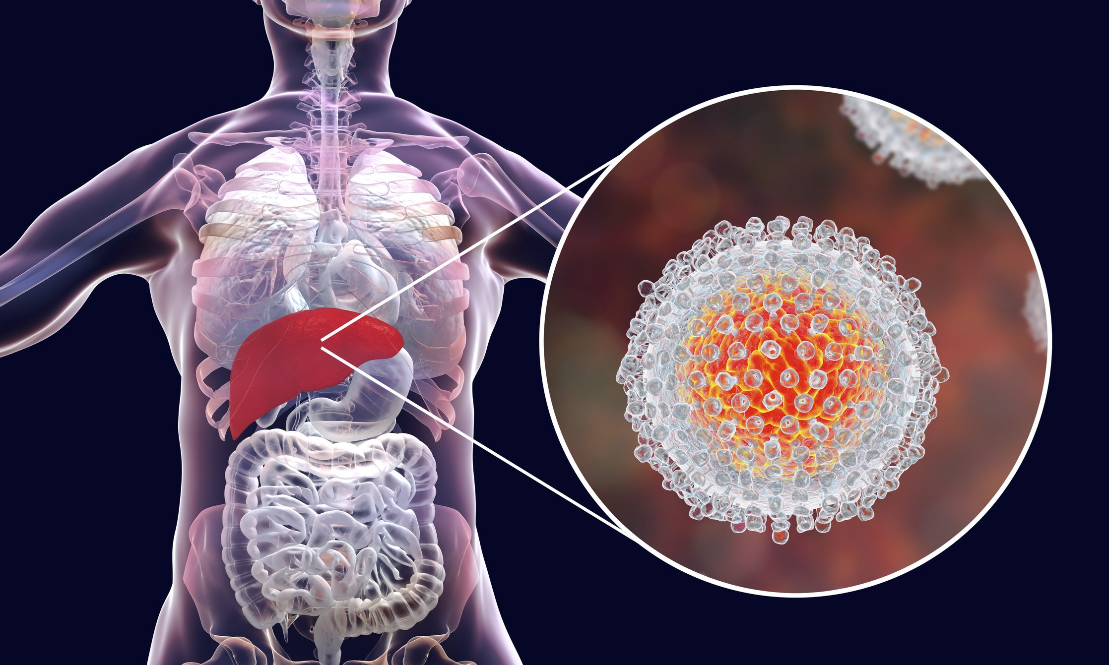 The Viral Time Bomb: Hepatitis C