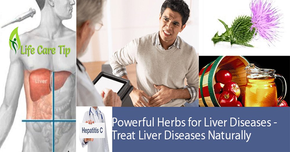 Tips to treat Hepatitis C naturally at home