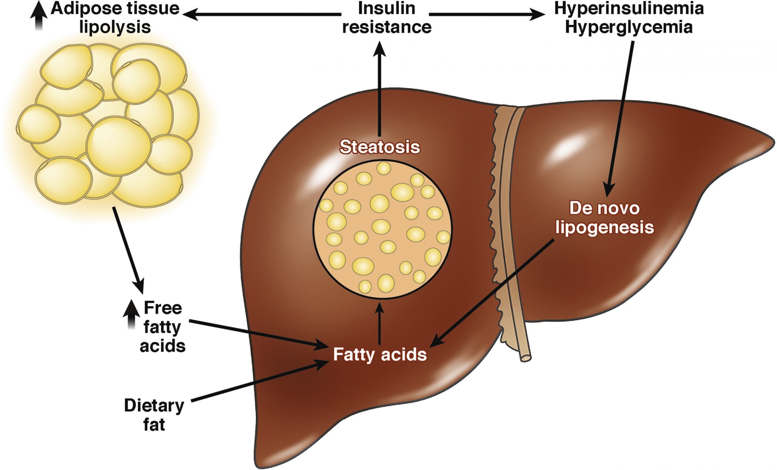 Treating Hepatic Steatosis and Fibrosis by Modulating Mitochondrial ...