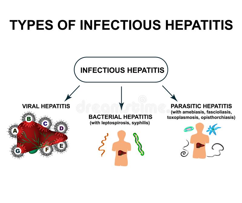 Types Of Viral Hepatitis. Classification Of Hepatitis A, B, C, D, E, F ...