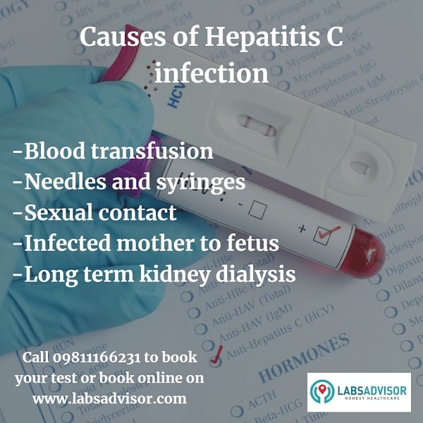 Up to 50% OFF on HCV Test Cost