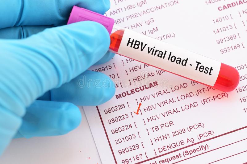 Viral hepatitis stock image. Image of fever, abuse, patient