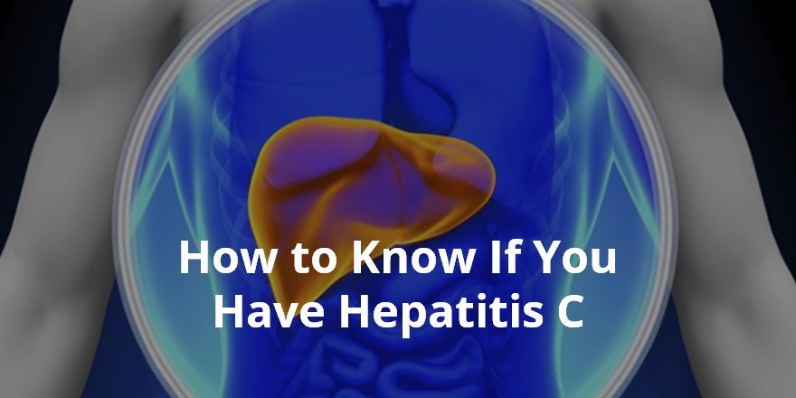 Wellness Lab Health Info: How to Know If You Have Hepatitis C