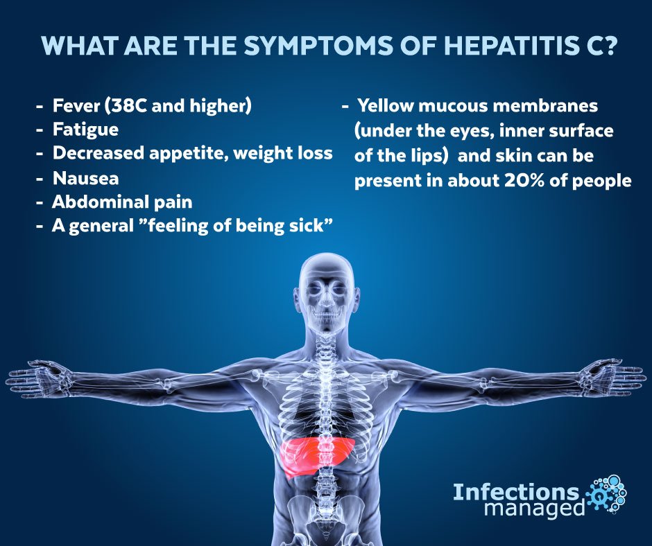 What are the symptoms of hepatitis C?