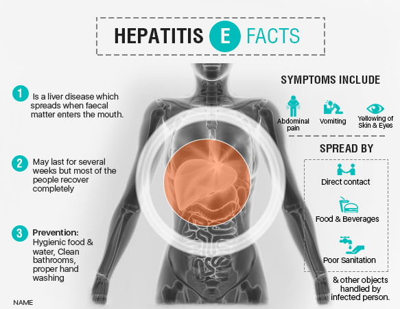 What is Hepatitis A &  E