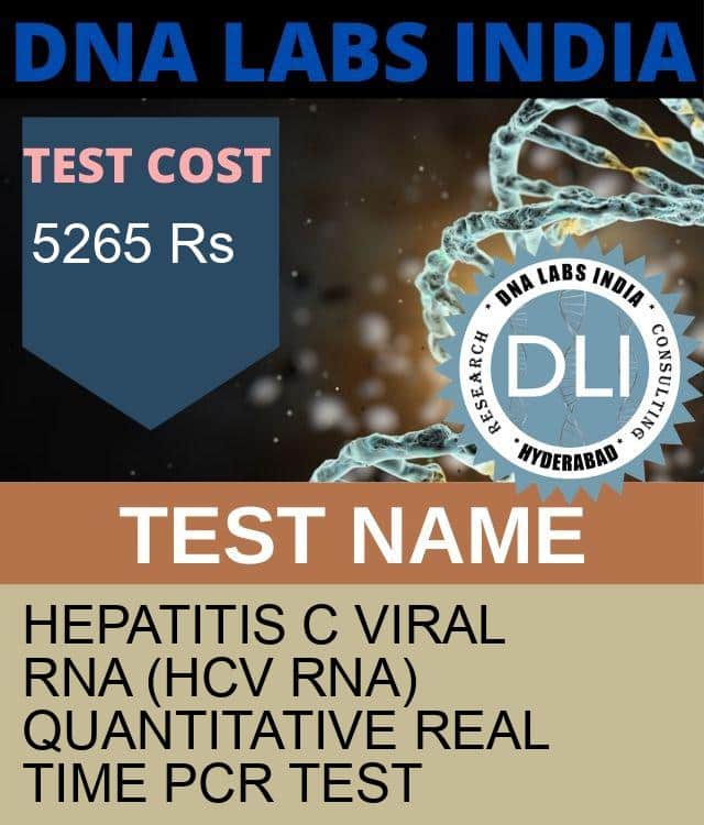 What is HEPATITIS C VIRAL RNA (HCV RNA) QUANTITATIVE REAL TIME PCR Test
