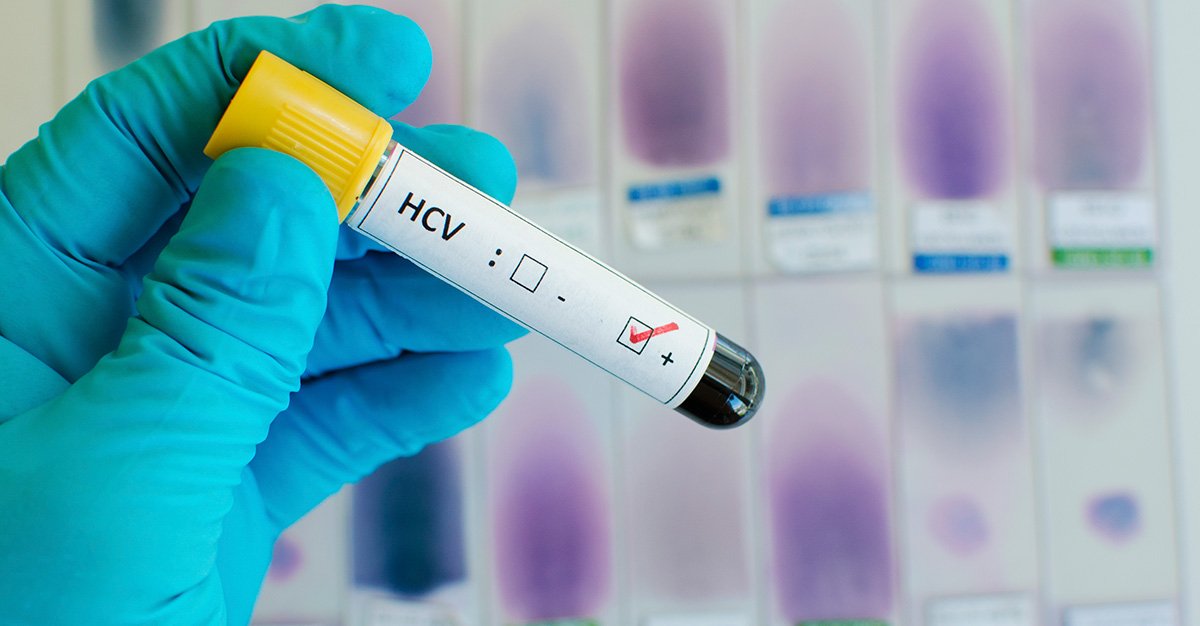What is Hepatitis Titer Testing And Do I Need It?