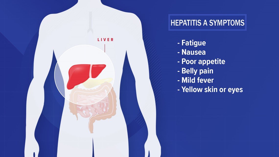What you should know about Hepatitis A and how it spreads ...
